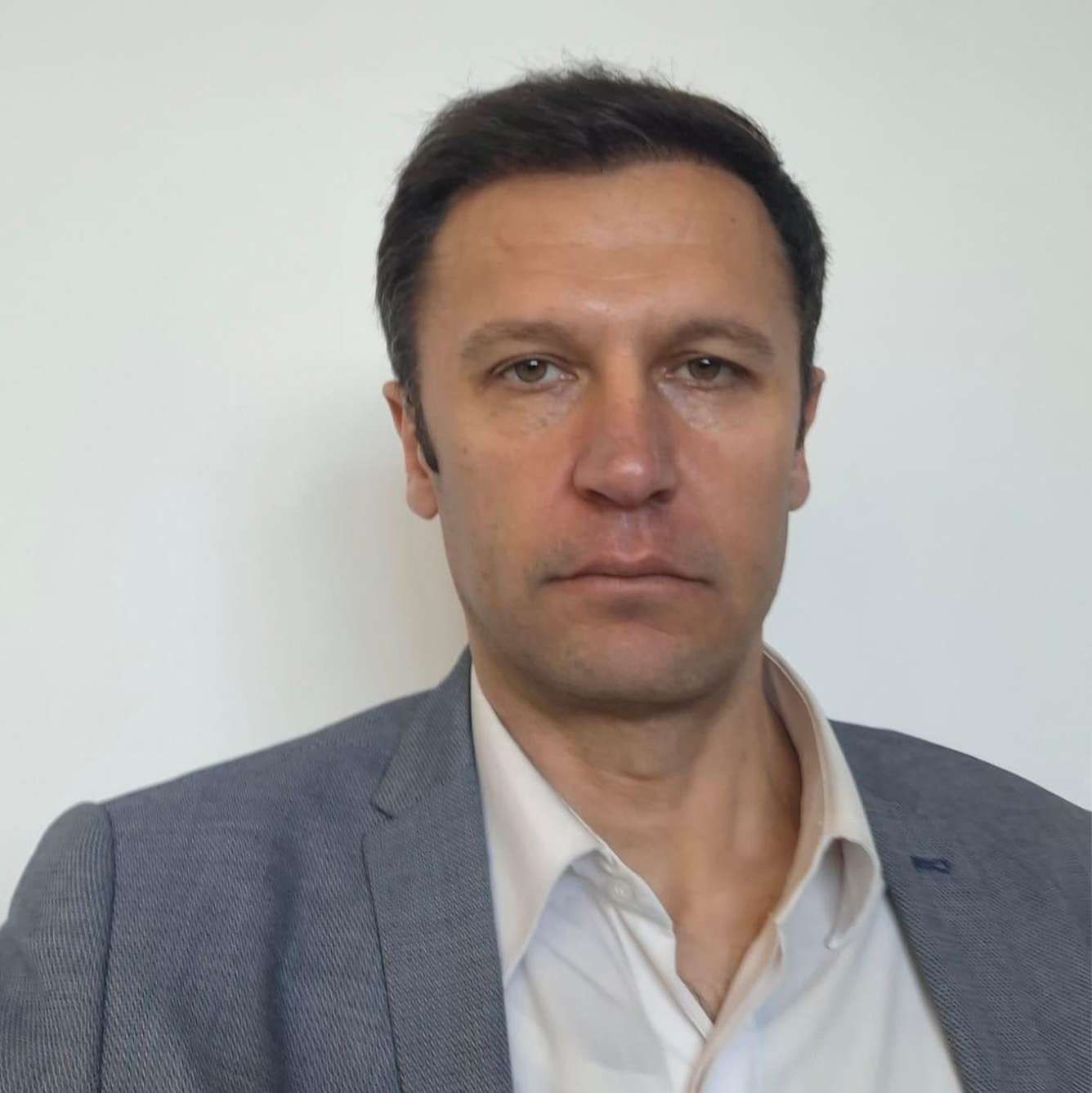 Amazing After Hair Transplant