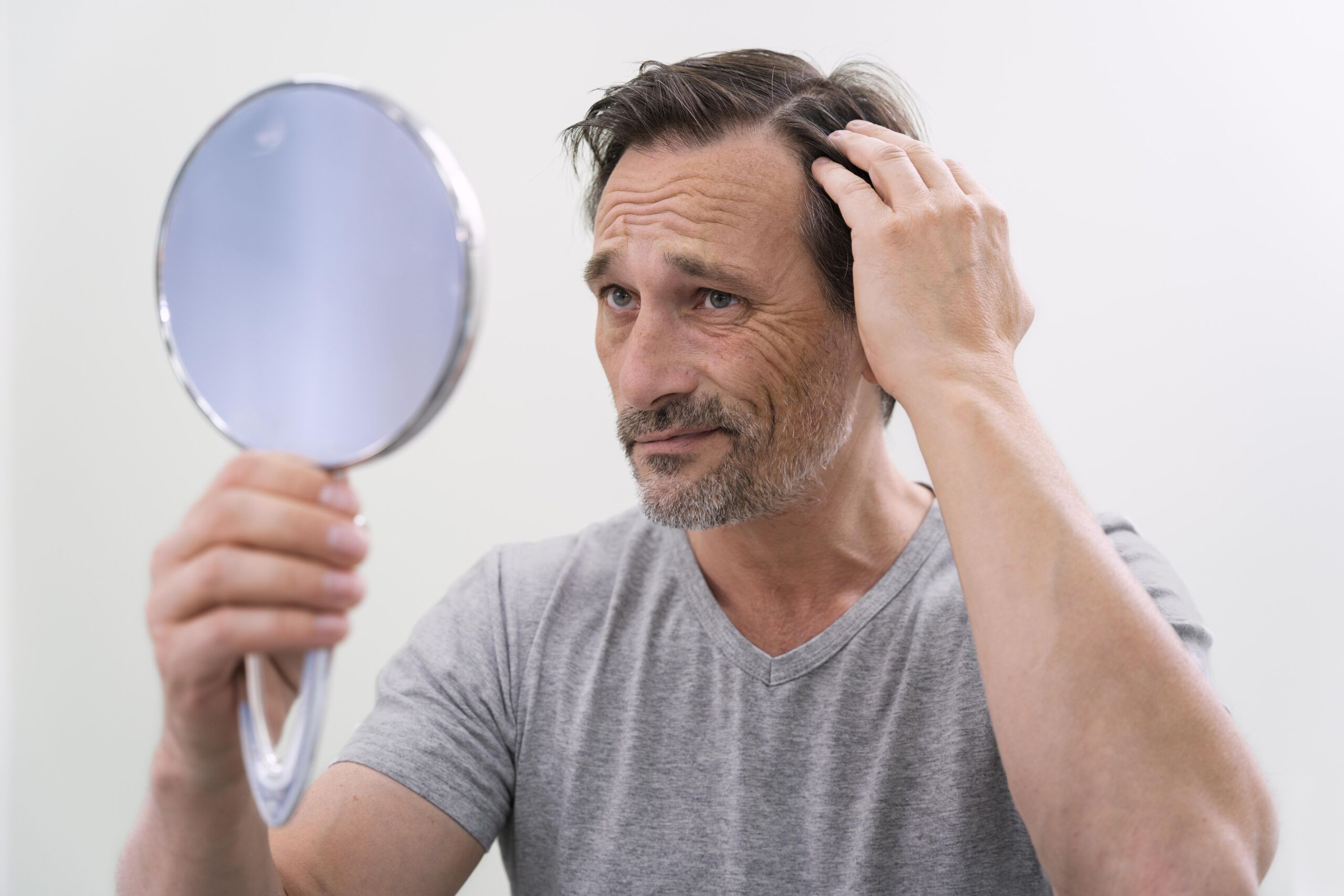 Man examining his hair loss in a mirror